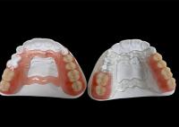 Dentadura extraíble parcial, prótesis dental extraíble para masticar y hablar