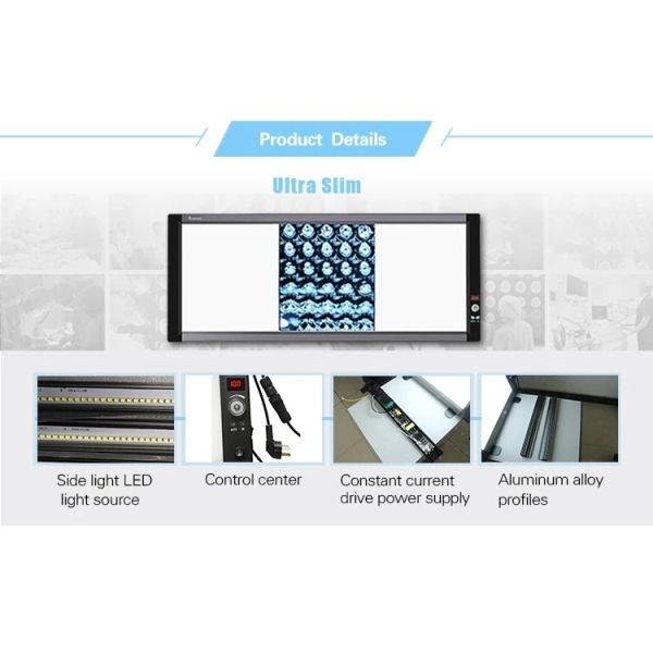 Hot Sale Manufacturer Supply LED Medical X-ray Film Viewer