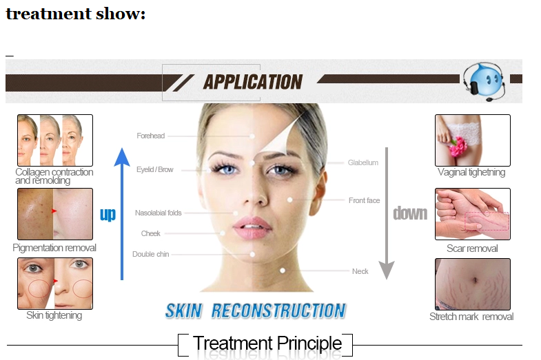 CO2 Fractional Laser Machine for Skin Resurfacing and Scar Removal Transform Your Skin