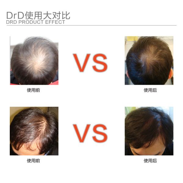 hair treatment Hair Growth Essence anti hair Loss Liquid dense unix hair conditioner Serum