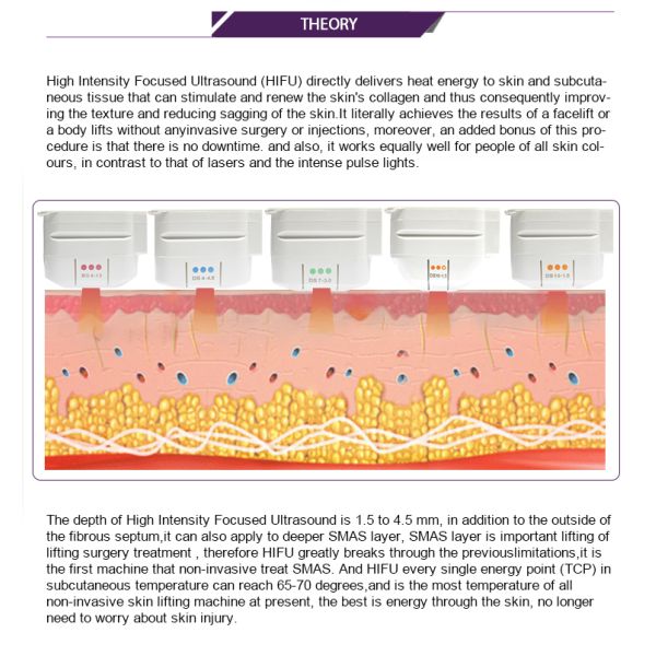 Вертикальные 3Д Хифу смотрят на поднимаясь машину, машину ультразвука высокой интенсивности сфокусированную