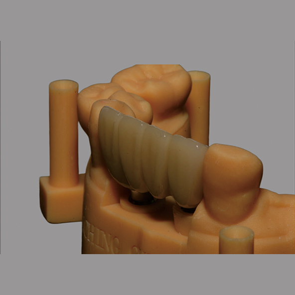 Gold Plating Nitrogen Titanium Abutments Dental Implants Cad/Cam Compatibility