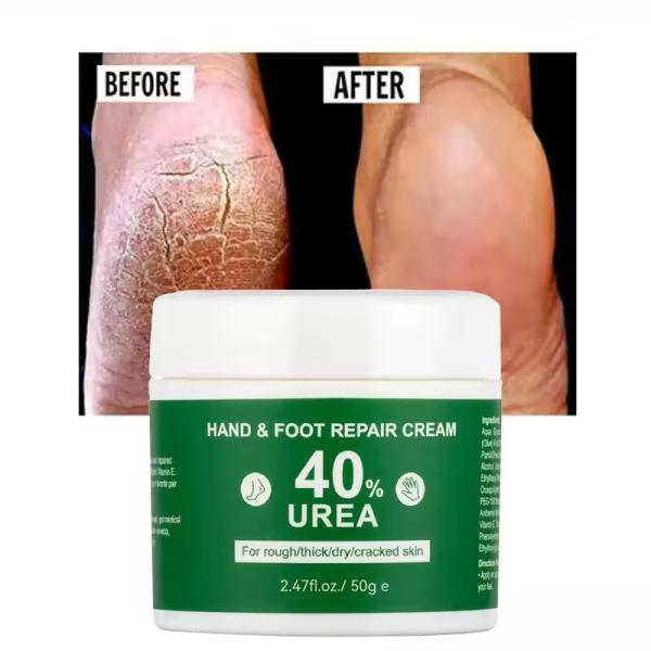 OEM Vitamina E Cuidados de mãos e pés Anti-seca Vaselina Ureia Creme Reparação de pés