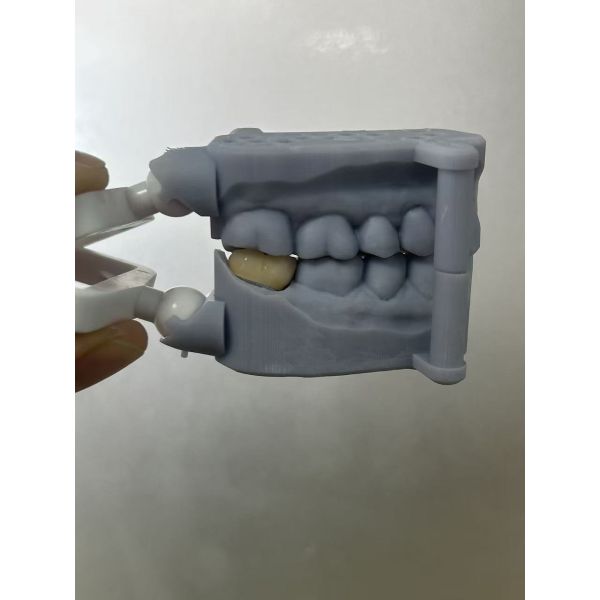 Full Zirconia Crown - High Strength Biocompatible Dental Crown for Durability