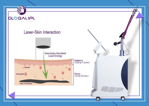 Q- Switch ND YAG Laser Machine Color Tattoo Removal 1064nm 532nm