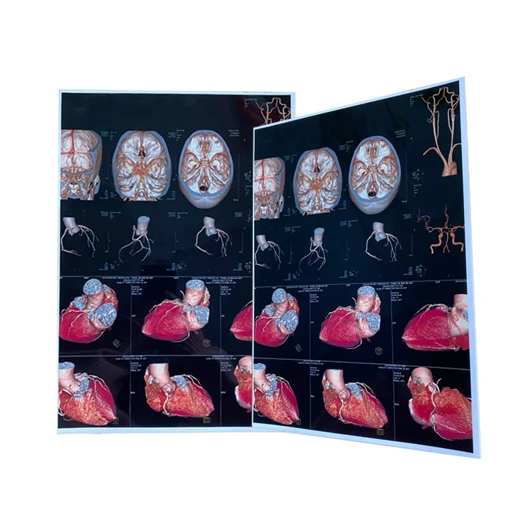 Медицинская рентгеновская сухая пленка медицинская рентгеновская струйная пленка с четким качеством изображения