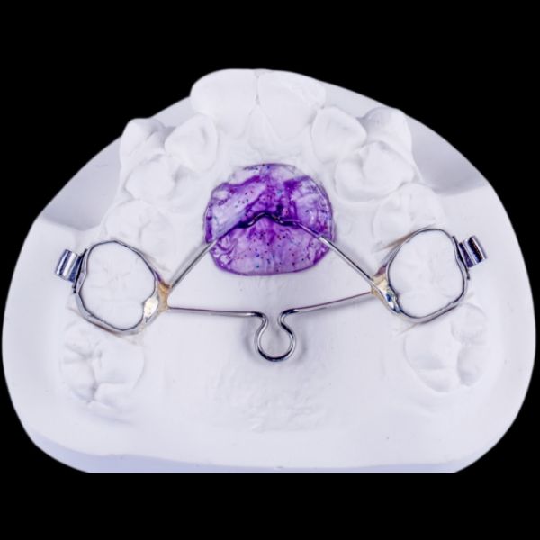 Stainless Steel Nance Appliance Palatal Bar Orthodontic Functional Appliance