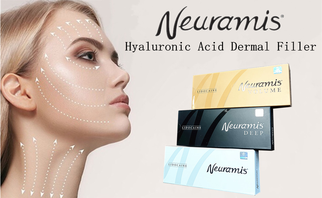 1 мл Dermal Filler Neuramis для поверхностной и глубокой обработки глубины лица