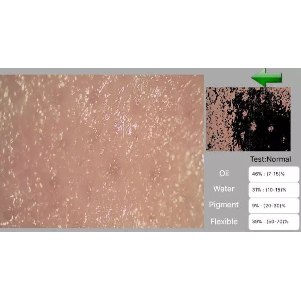 Skin Moisture Sensor Digital Skin Analyzer With Skin Lense And Scalp Lense