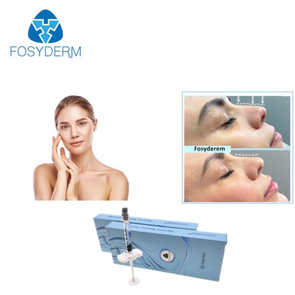 Linha profunda enchimentos cutâneos à base de ácido hialurónicos de Fosyderm 2ml