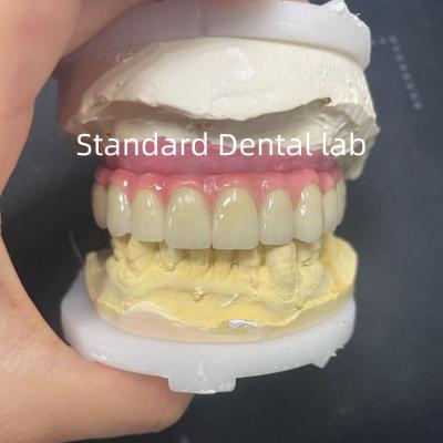 Malo Bridge Hybrid Zirconia All On Four / Six Zirconia Implant Bridge TItanium Bar