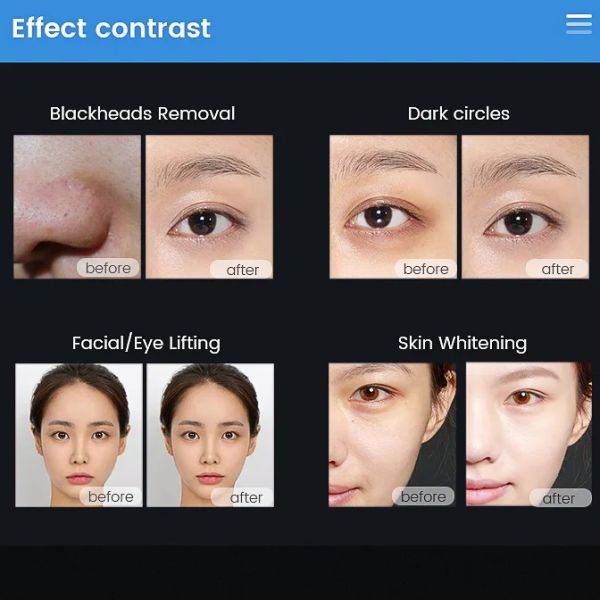 10-in-1 Multifunctional Facial Cleanser with Diamond Peeling Blackhead Removal Dermabrasion Skin Tightening and Whitenin