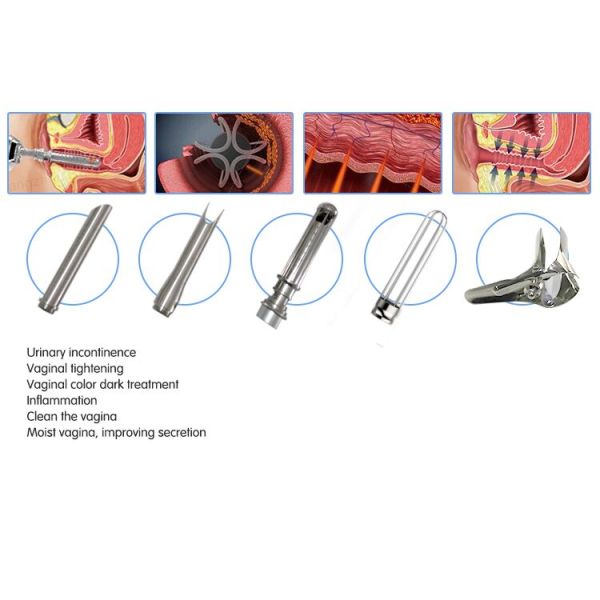 2017 new pixel rf co2 fractional laser /dermatological skin beauty machine