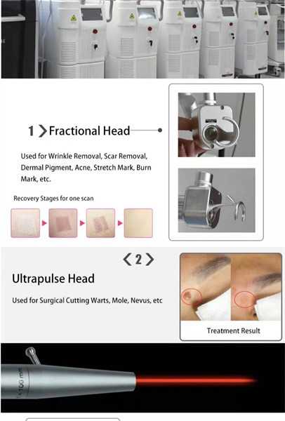 Pele que aperta a máquina 110V-250V do tratamento do laser do CO2