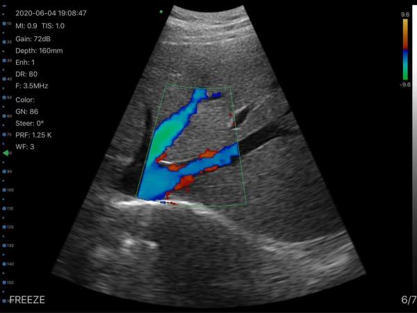 Linear/Convex/Phased Array 3 in 1 Handheld USB Ultrasound Double Probes Wireless Color Doppler Scanner