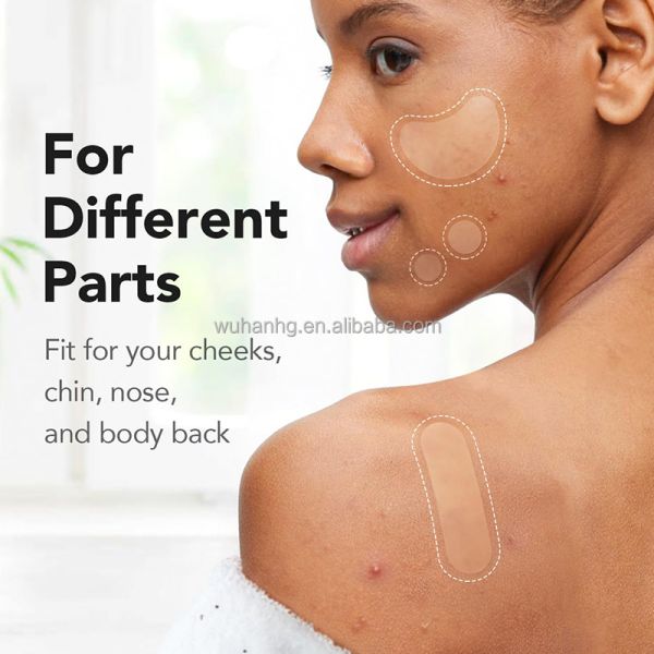 Varied Tones Hydrocolloid Pimple Patches For Acne Care Customized Size