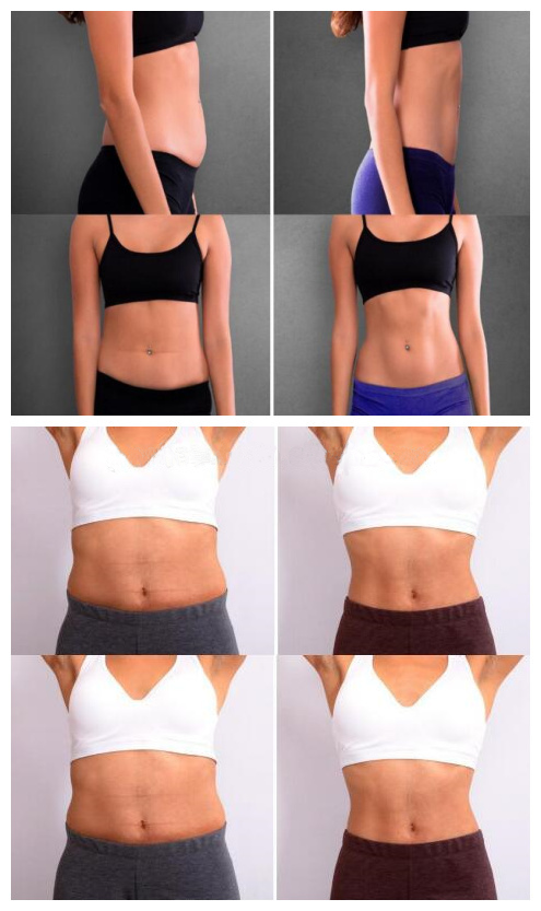 Стимулятор мышцы ISO безболезненный EMS для жирного горения