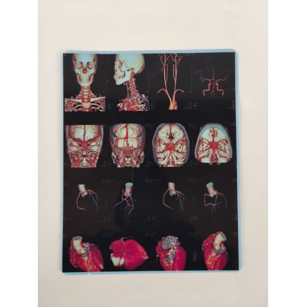 Струйный Imager принтера x Рэй для фильма печатания 9600x2400 Dpi