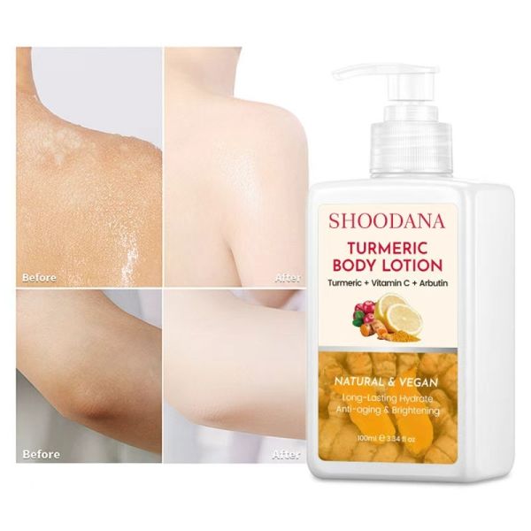 OEM Vegan Lemon Turmeric Kojic Acid Whitening Face & Body Brightening Nourishing Vitamin C Collagen Cream for Women