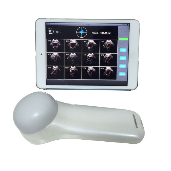Portable 4D Wireless Bladder Scanner WIFI Ultrasound Probe for Evaluation of Residual Quality After Urination