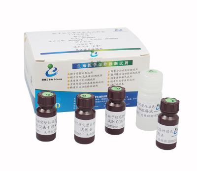 Metodologia da pilha de fluxo do jogo AOT do teste da fragmentação do ADN do esperma