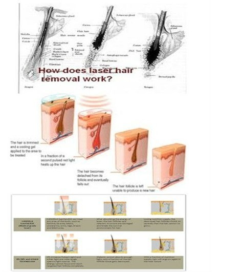 Beauty Salon machine professional diode laser hair removal machine for all skin types
