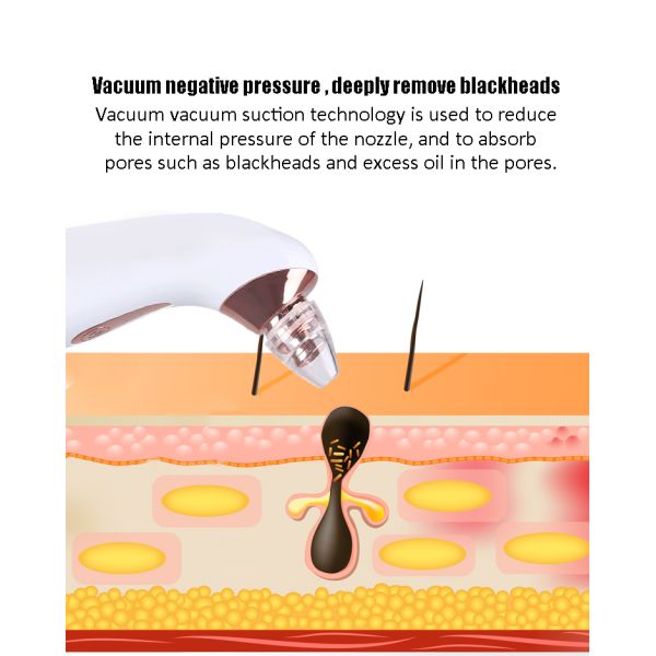Eco Friendly Electric Blackhead Remover Tool Beauty Skin Acne Rejuvenation