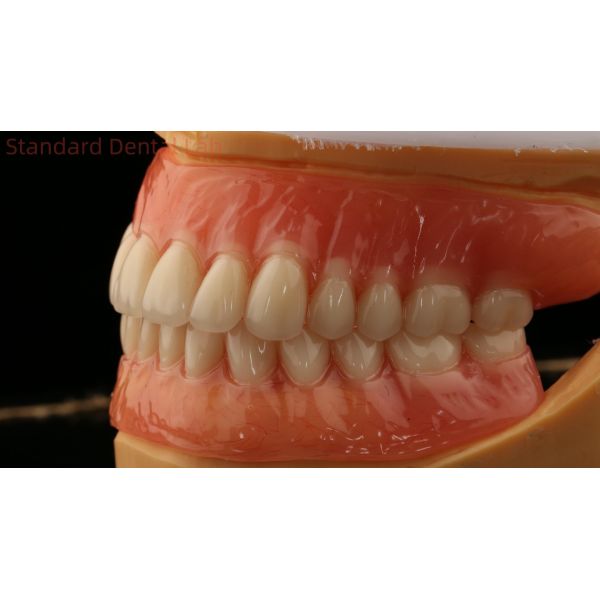 Heat Cured Ivoclar Full Acrylic Denture Dental Lab High Accuracy High Esthetic Advantage
