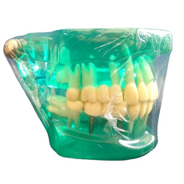 DTC Orthodontic Dental Typodont Brackets Model Custom Made for Manual and OEM