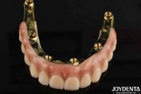 Dental Prosthesis Ti-Bar Zirconia Hybrid Bridge With High Biocompatibility Standards