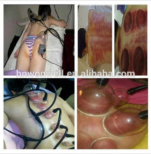 Vacuum cupping therapy breast enlargement enlarge massager