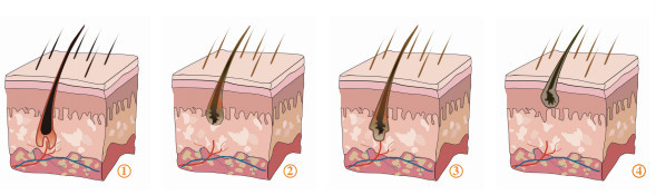 Сильная машина удаления волос Ipl Shr системы охлаждения быстрая для женщины