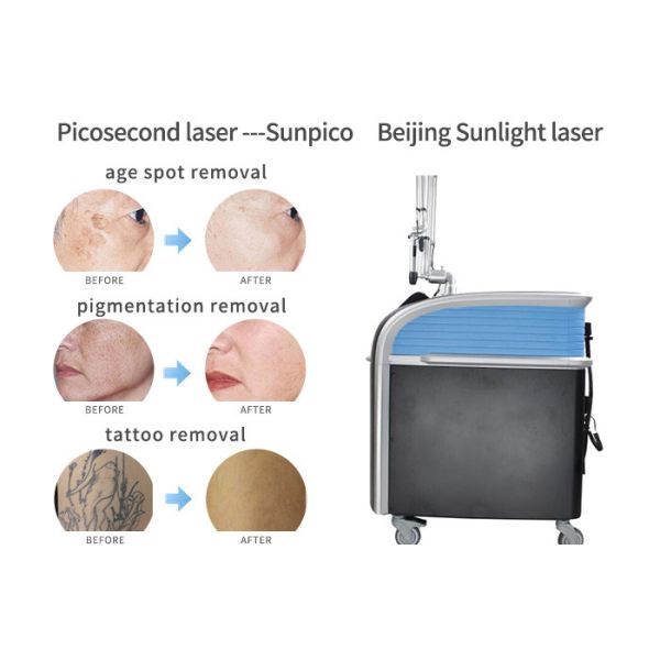 1064nm Laser Tattoo Removal Device , Picosure Fractional Tattoo Eraser Machine