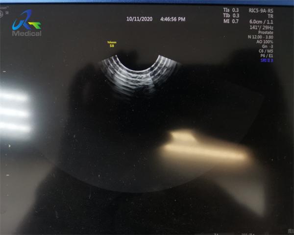 GE RIC5-9A-RS 4D Ultrasound Probe Repair Crystal And Dome Replace 4D Circuit