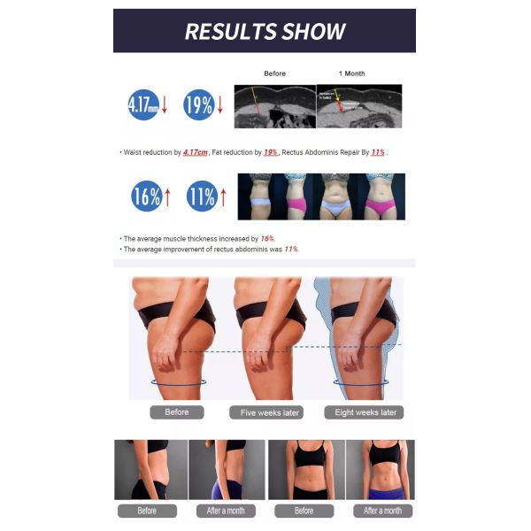 2/4 Handles Emslim Nova Machine Automatic Body Slimming Equipment 2800w