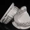 Dental Occlusal Splint Custom Made for Perfect Fit and Comfortable Night Guard Denture Lab China