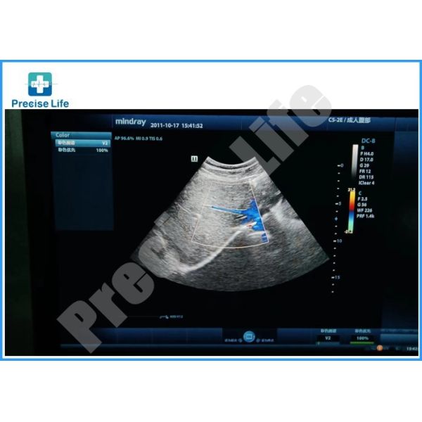 Датчик зонда ультразвука Mindray C5-2E выпуклый для машины DC 8