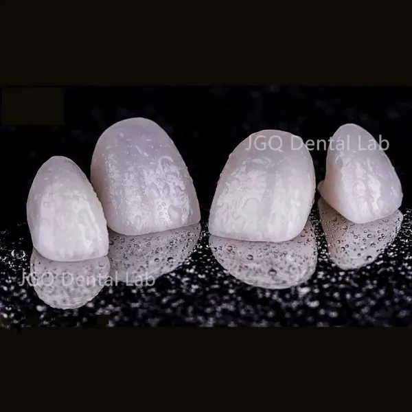 Dental Occlusal Splint Custom Made for Perfect Fit and Comfortable Night Guard Denture Lab China
