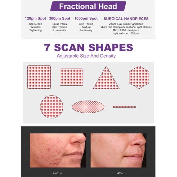 3 In 1 Fractional Co2 Laser Machine Skin Care Vaginal Tightening