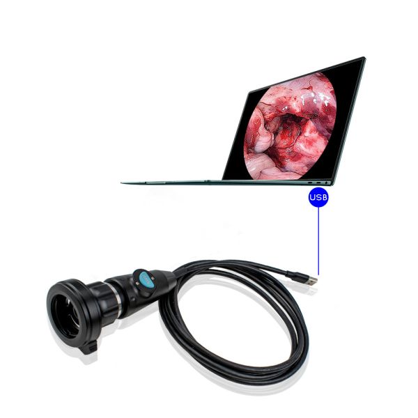 CE Certified USB 3.0 1080P Portable Endoscope Camera with Sony CMOS