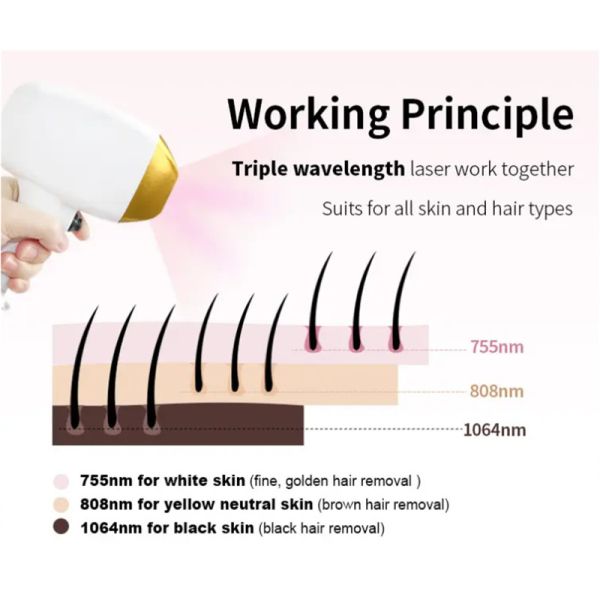 Мультифункциональная 3 в 1 808nm диодная лазерная эпиляция эпиляция татуировки