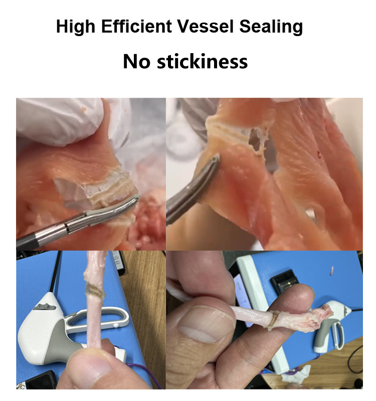 7mm Thick Tissue Sealing Fast Coagulation Nano Coated Electrosurgical Unit Maryland Jaw Ligasure Vessel Sealer For Laparoscopic Surgery