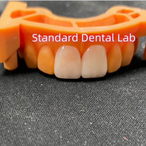 Высокая стабильность цвета Ivoclar Emax ламинированные фанеры высокая прозрачность