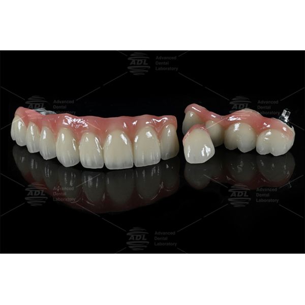 Hypoallergenic PFZ dental solutions tailored to meet diverse clinical and dental lab needs services ensuring precision