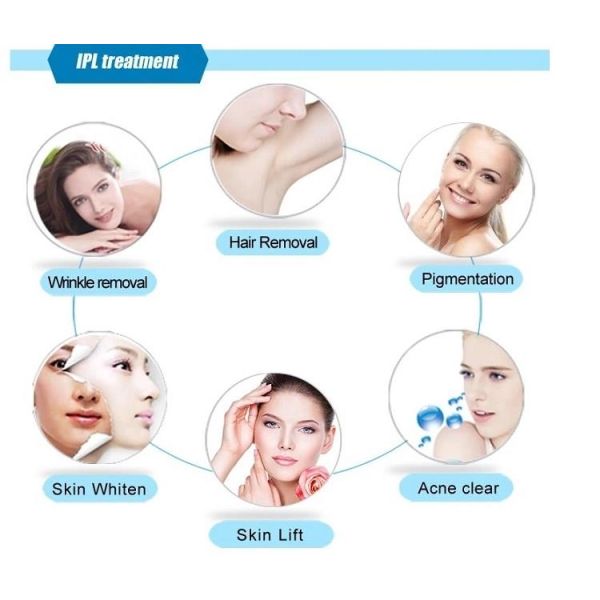 Сильная машина удаления волос Ipl Shr системы охлаждения быстрая для женщины