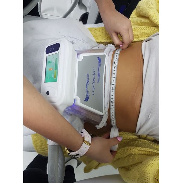 2019 trending products 4 handles working simultaneously 10.4 inch fat freeze cryolipolysis machine