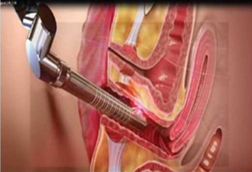 Частичное влагалищное затягивая оборудование лазера СО2 с США импортировало пробку FemiMED RF