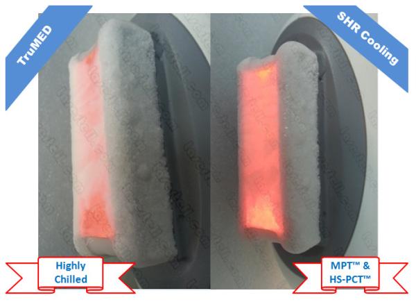 CE IPL Laser Equipment Hair Removel E Light For Upper Lip / Underarm / Face