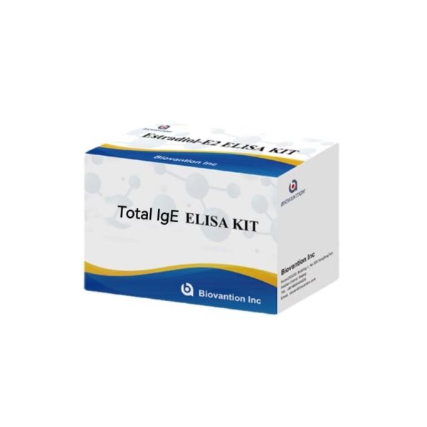 Total IgE Antibody IgE ELISA Test Kit In Vitro Diagnostic Enzyme