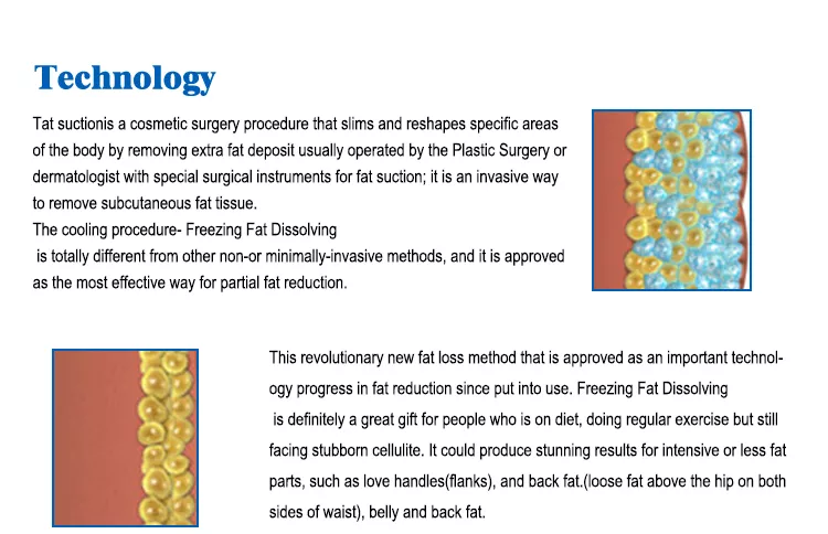 Máquina de congelación gorda portátil de Cryolipolysis, pérdida de peso del vacío Cryo que adelgaza el dispositivo